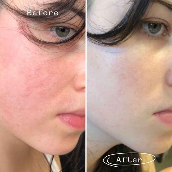 Pai The Light Fantastic™ Face Oil Mini - Picture 3 of 4